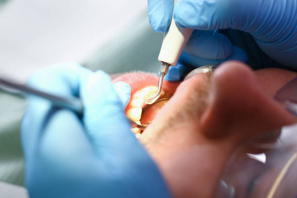 Best Emergency Denture Repair in Toro Nyon, CA