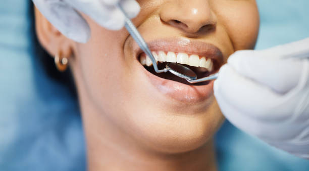 Best Walk-In Emergency Dental Services in Toro Nyon, CA